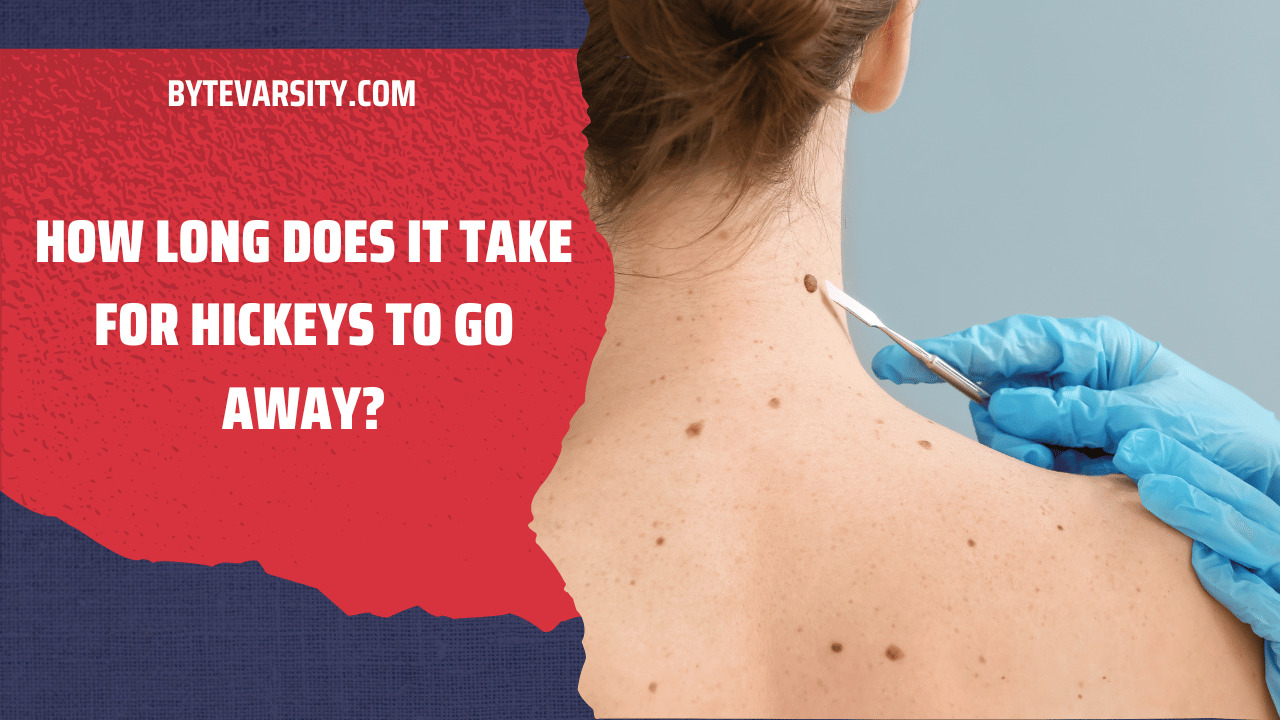 How Long Does it Take for Hickeys to Go Away?