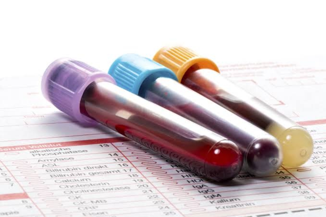 What Your Fertility Specialist Can Tell You About Your Blood Test Results